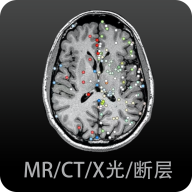 影像解剖图谱免费版2024